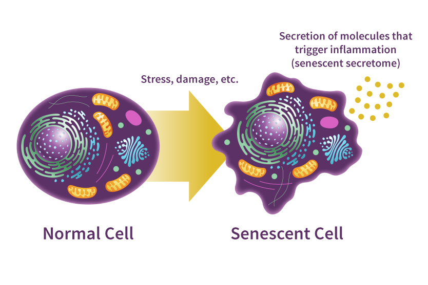 graphic showing a normal cell and how it changes into a senescence cell after stress and damage, and the senescent cell secretes molecules that trigger inflammation